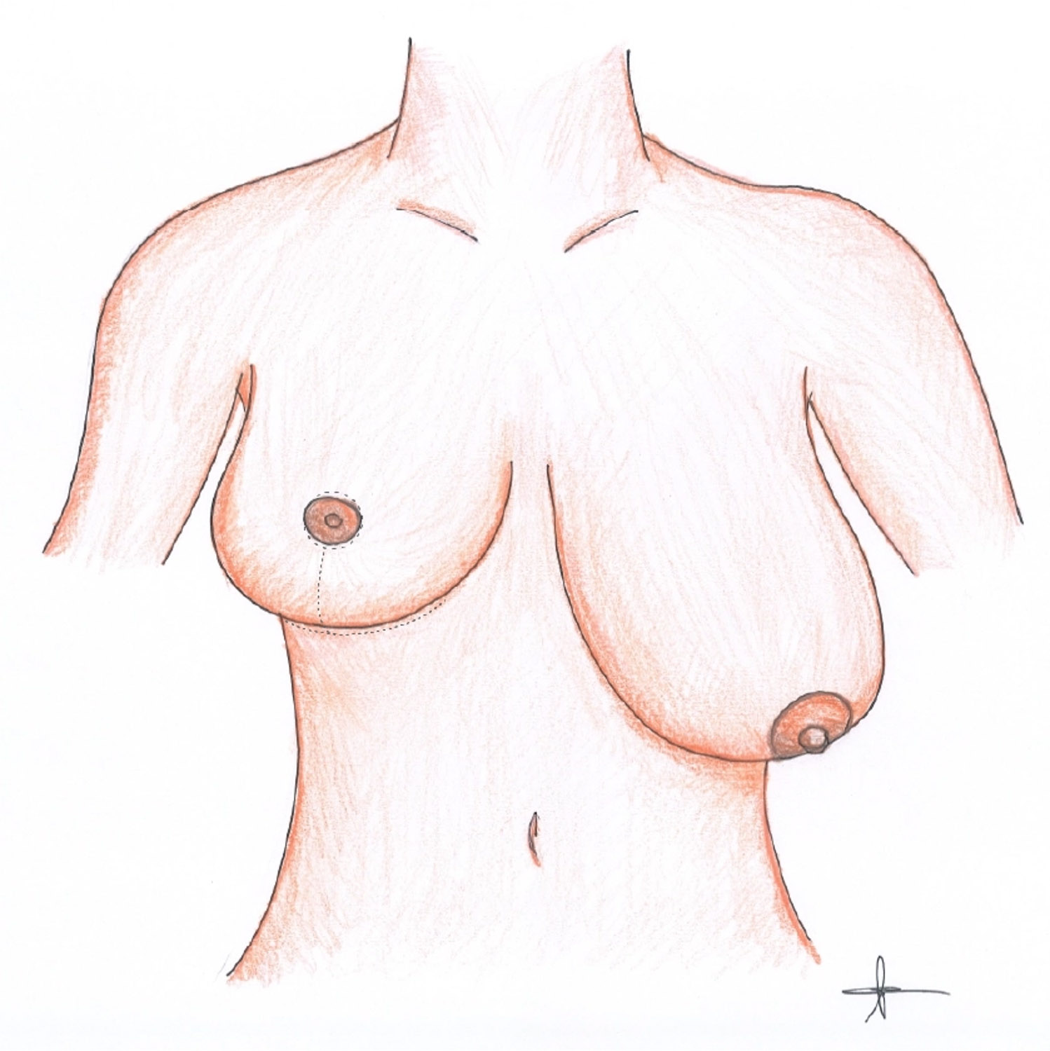 my clinique illustration 05