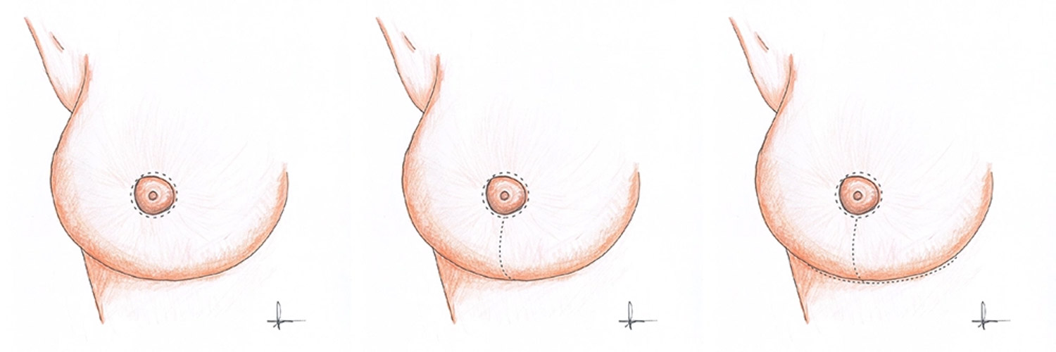 my clinique illustration 07