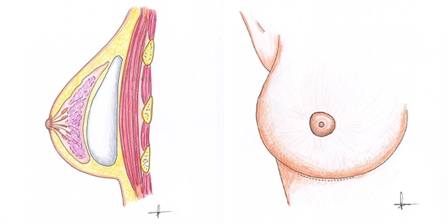 my clinique illustration 11