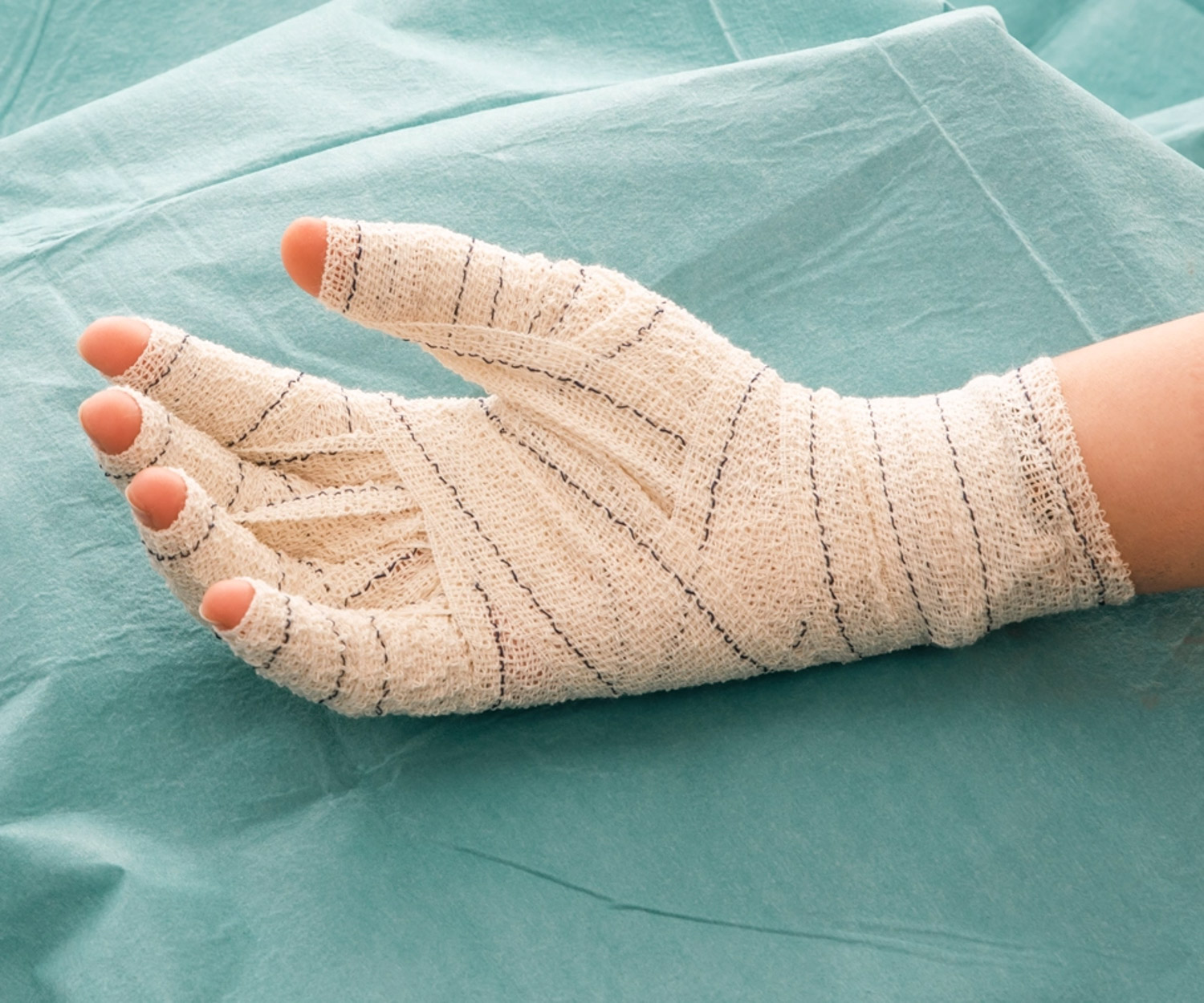 my clinique lesions cutanees brulures