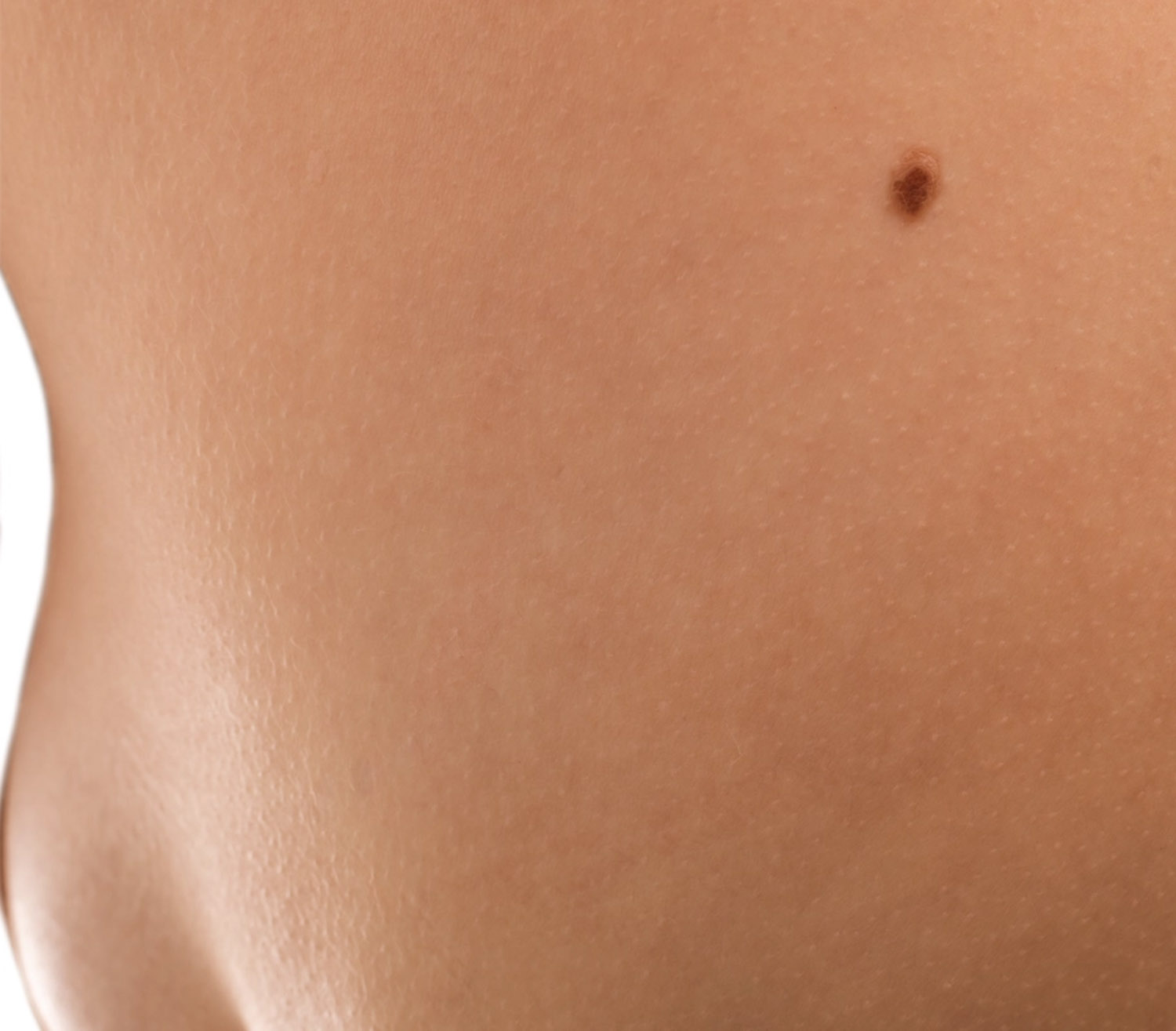 my clinique lesions cutanees deroulement de l intervention