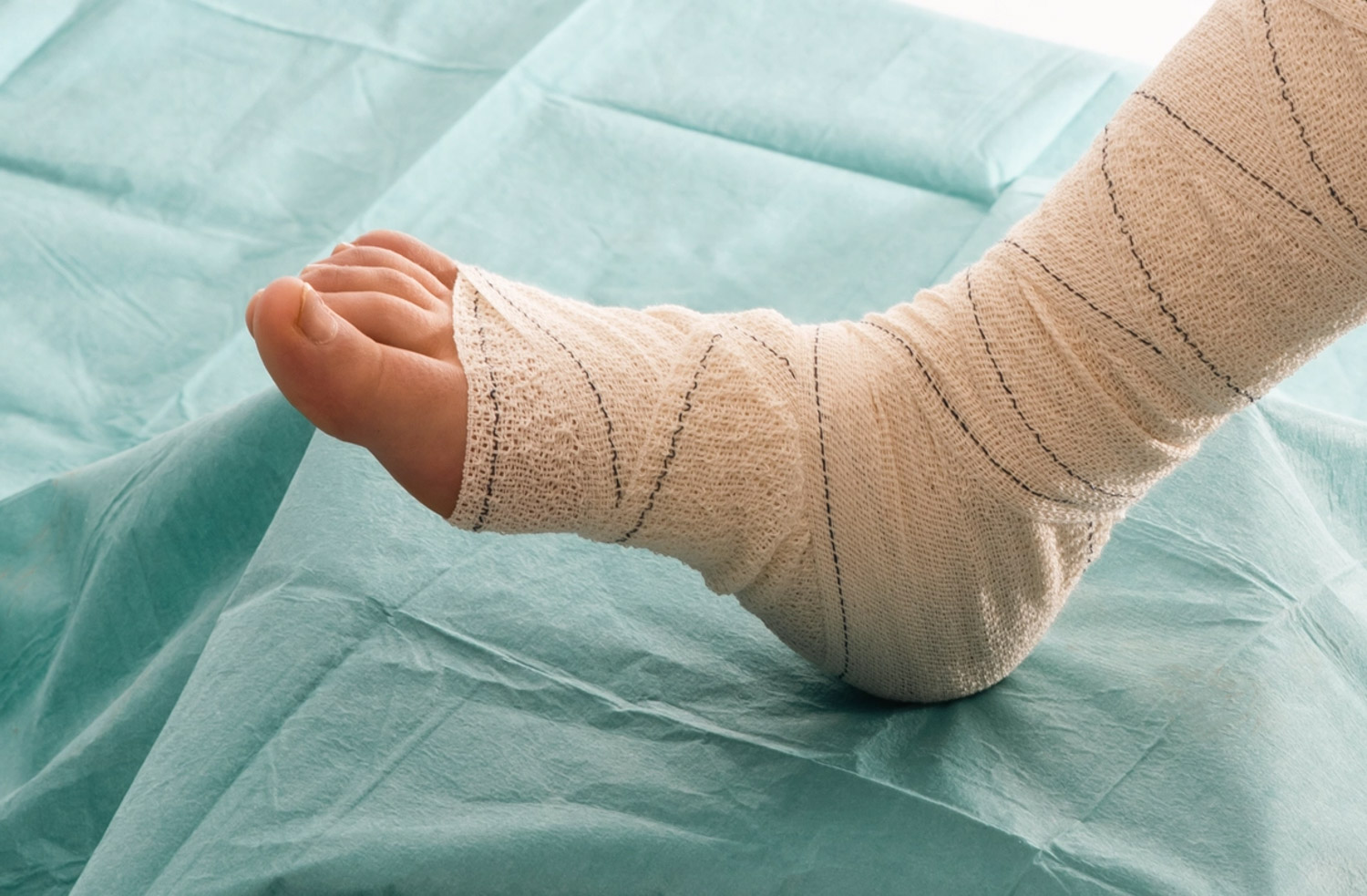 my clinique lesions cutanees plaies chroniques