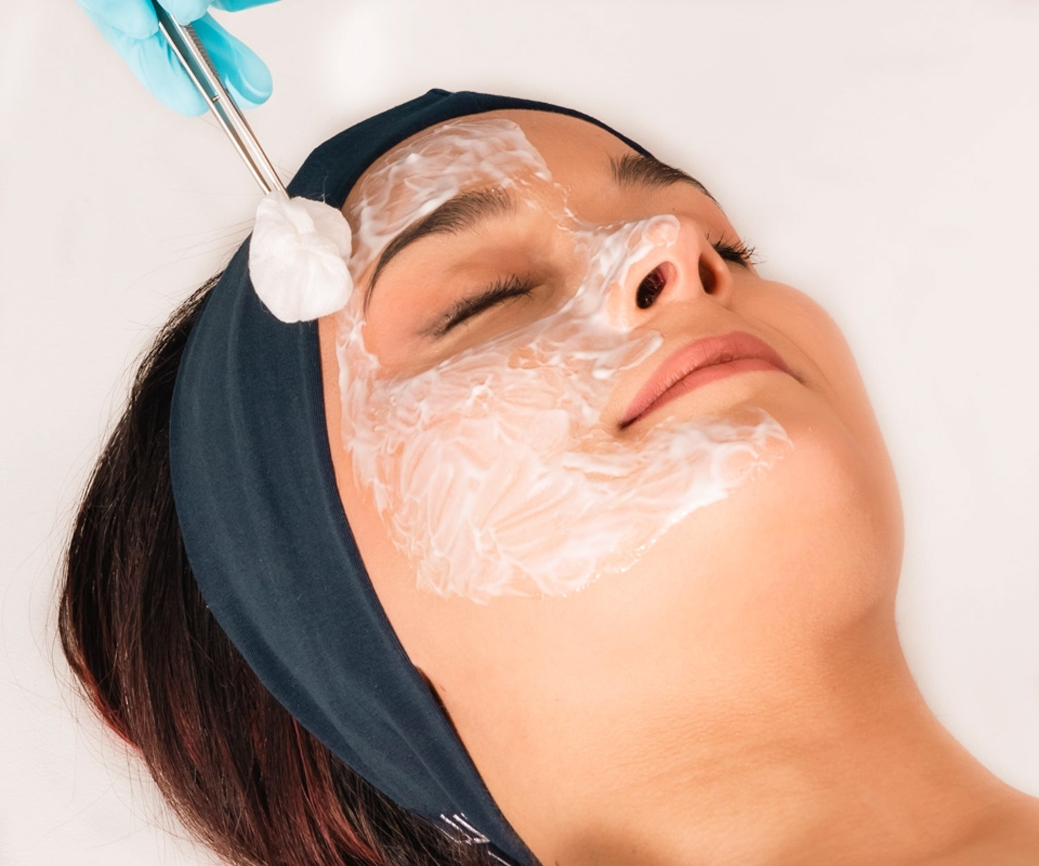 my clinique medecine esthetique peeling