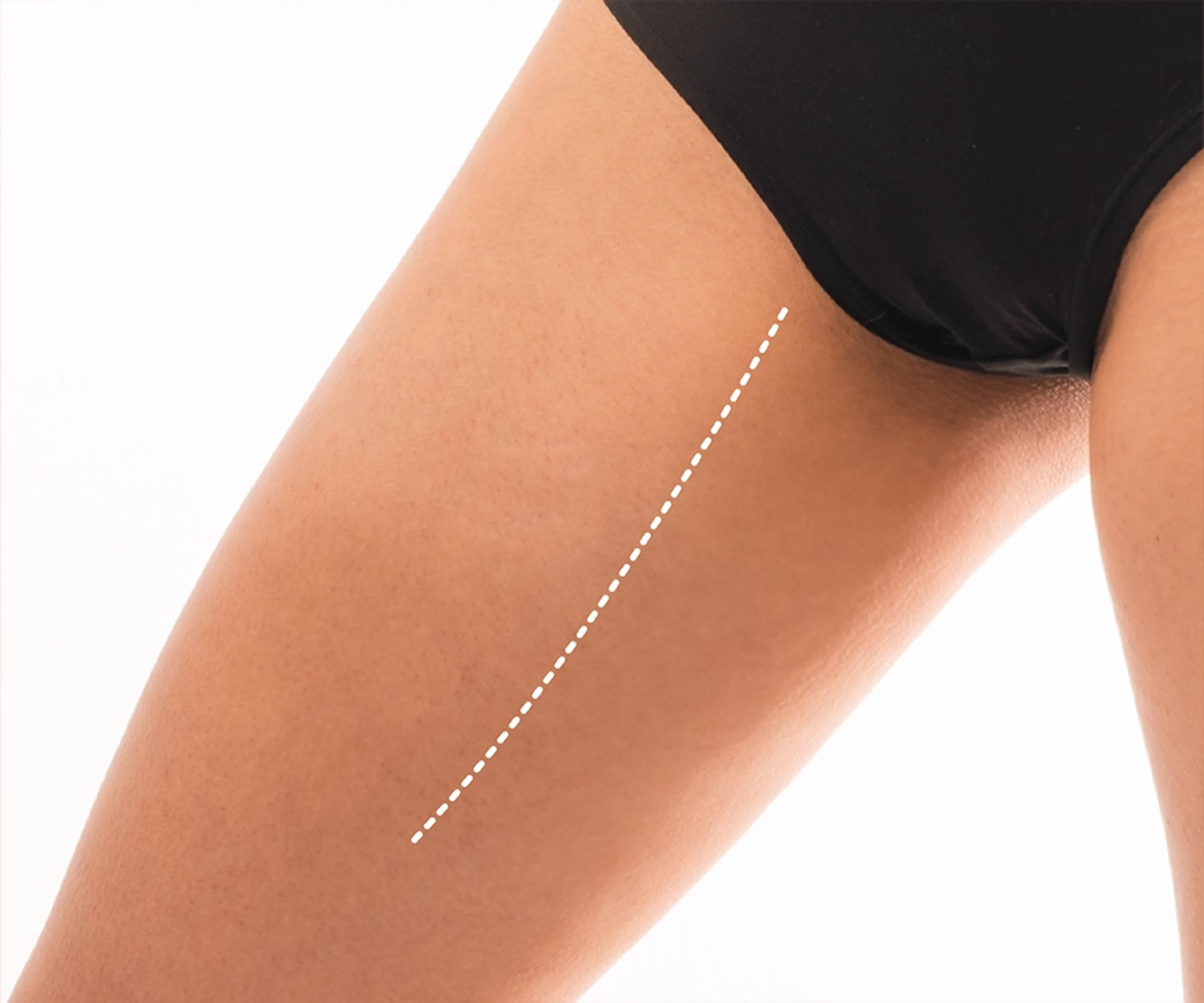 my clinique silhouette lifting des cuisses