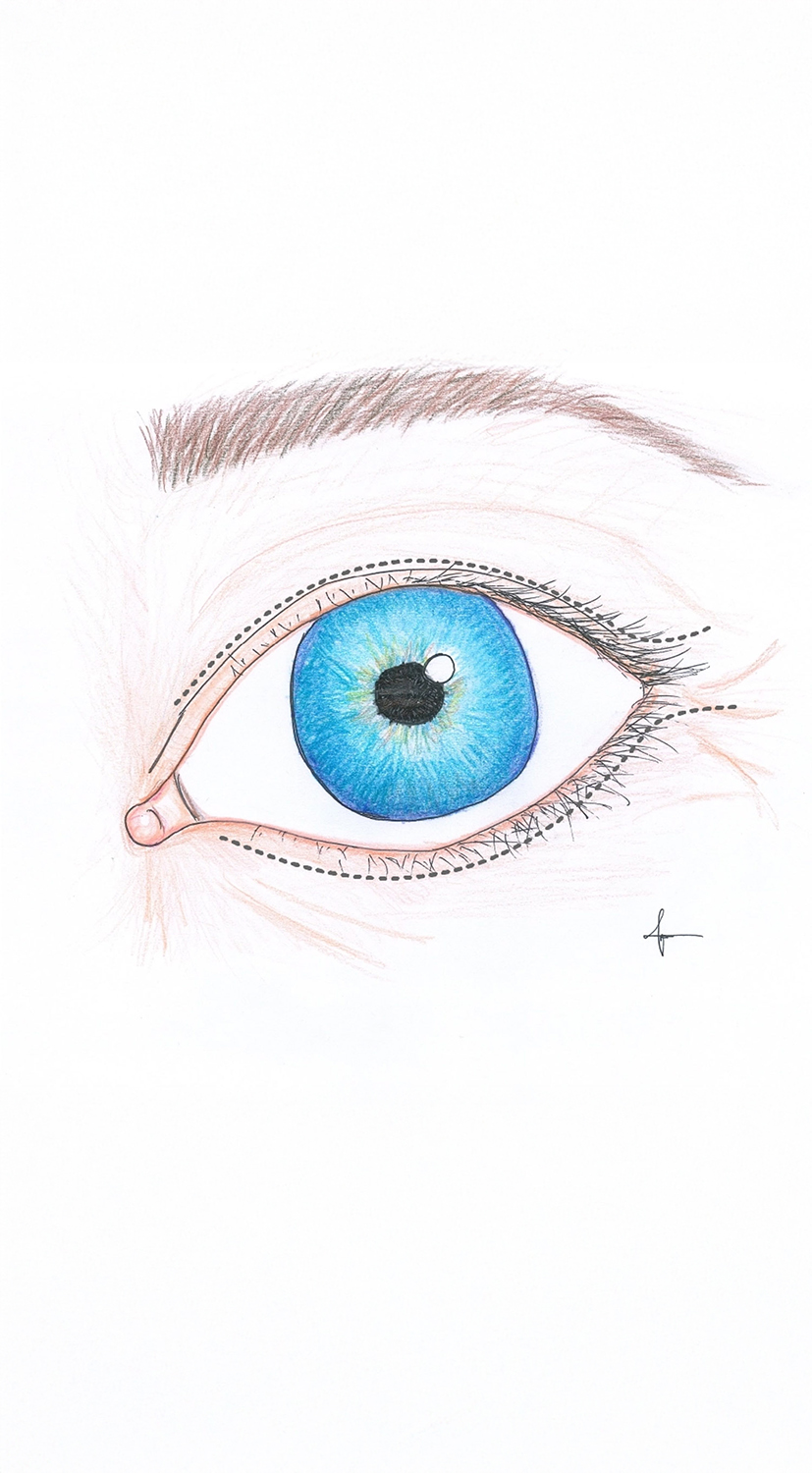 my clinique illustration 04 2