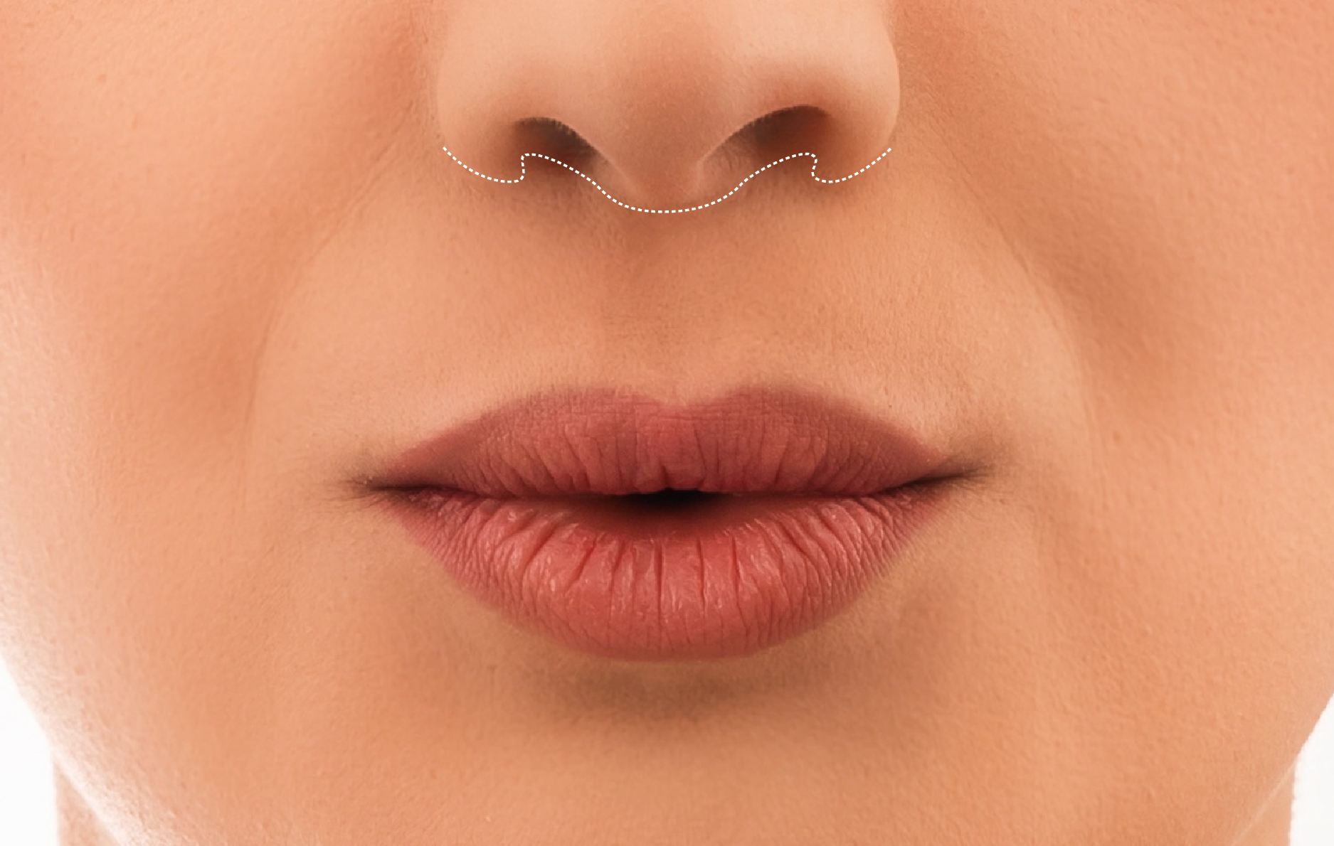 my clinique visage liplift