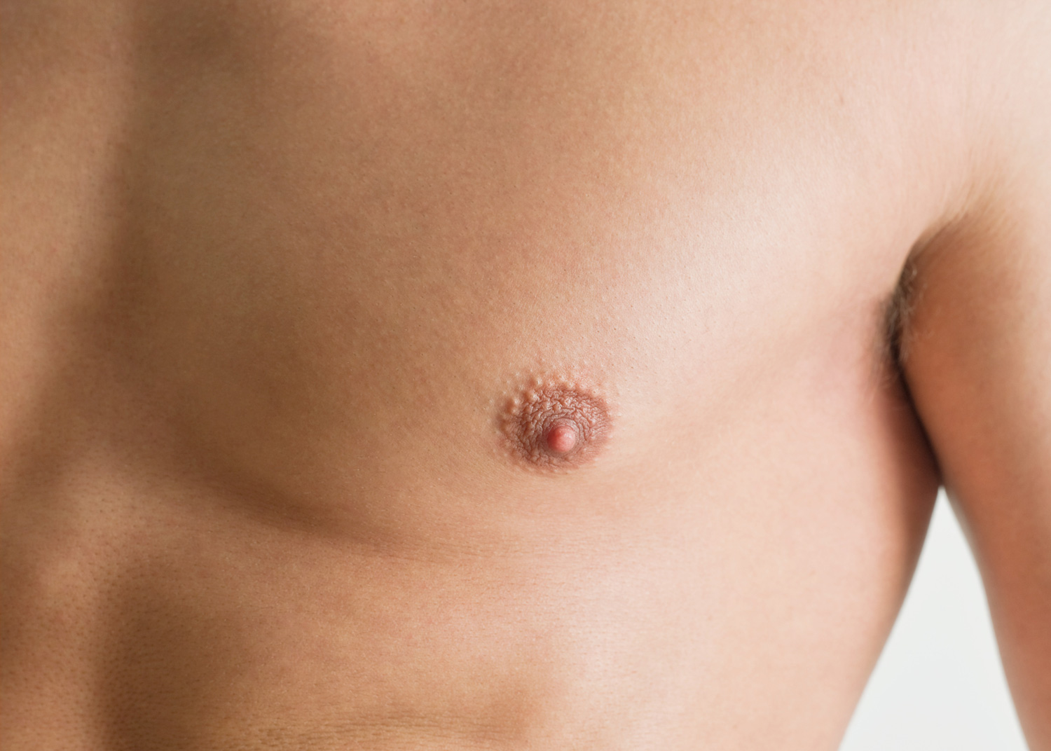 my clinique medecine gynecomastie header